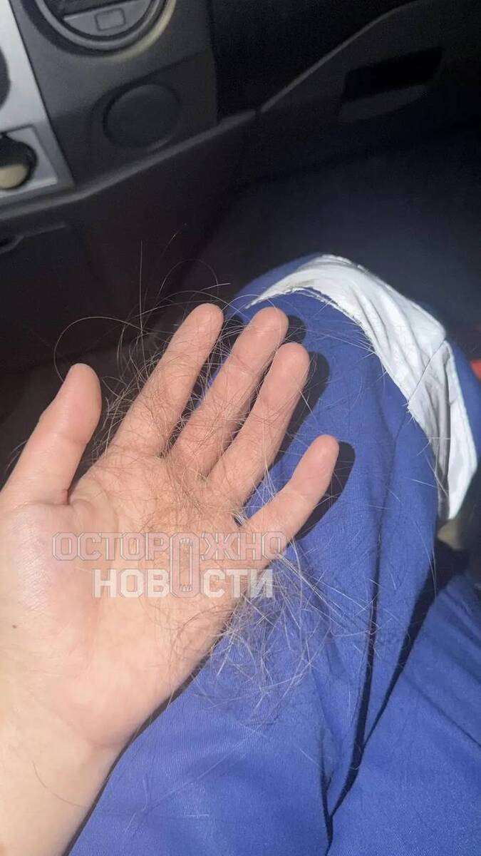 В Пятигорске родственники пациентки избили фельдшера скорой помощи qztiqtkiqeziudkmp